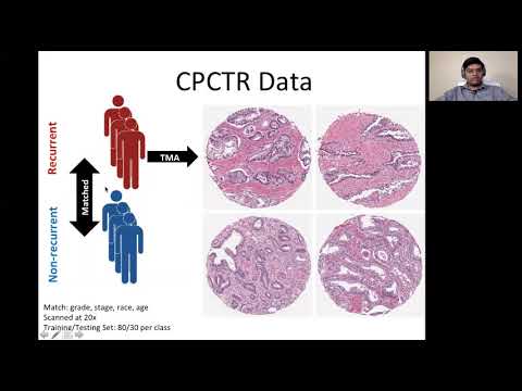 Vignette de la vidéo YouTube 9DH4ZJvmVm0