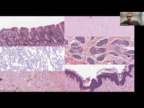 Vignette de la vidéo YouTube eI1w7kmhyJI